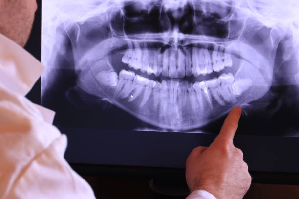 Best Emergency TMJ Treatment in Bedford, TX