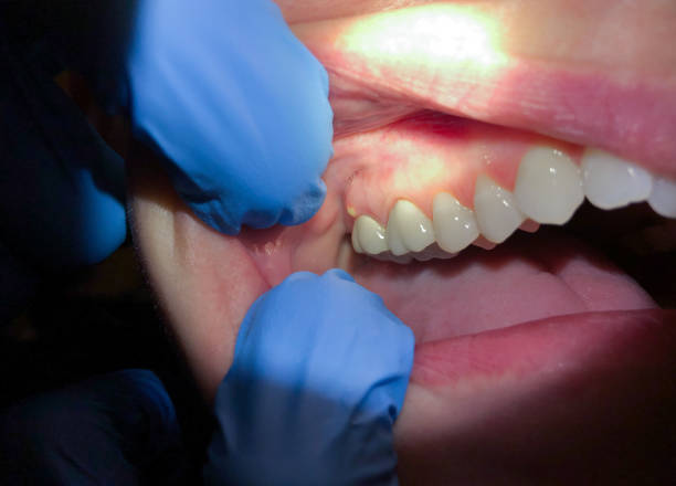 Best Urgent Care for Lost Fillings or Crowns in Bedford, TX