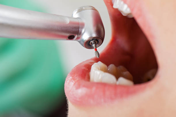 Best Cosmetic Emergency Dentistry in Bedford, TX